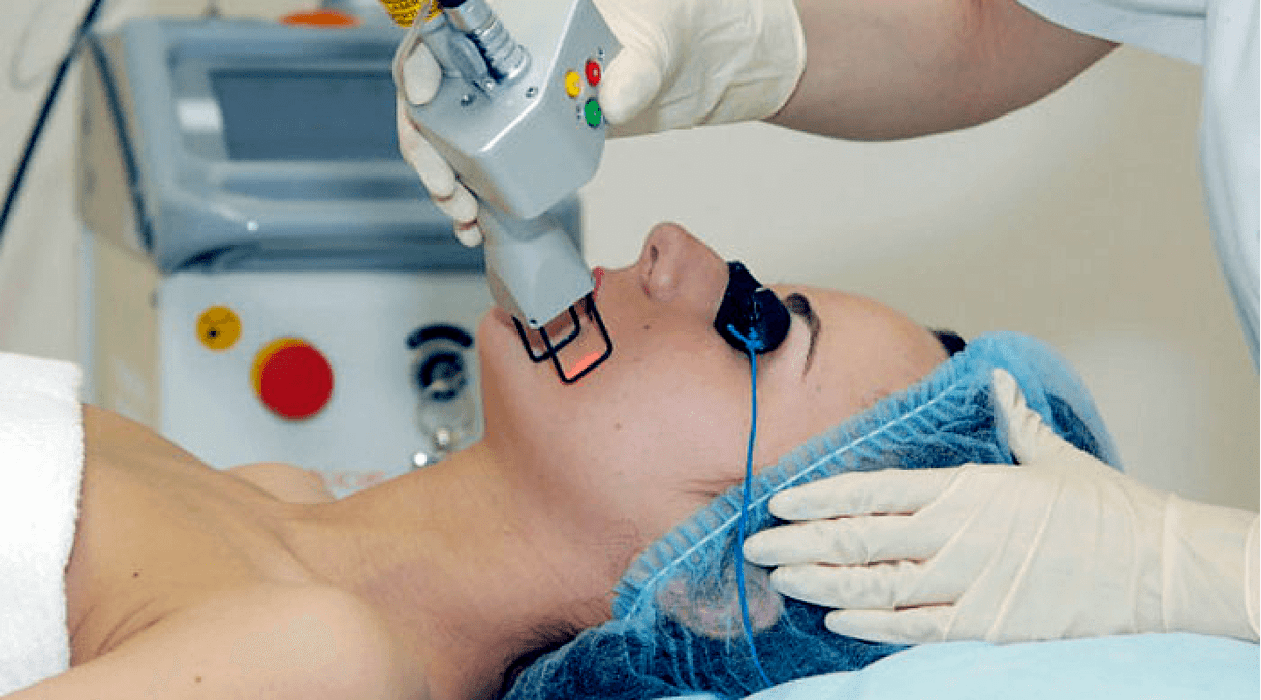 usoro rejuvenation akpụkpọ laser